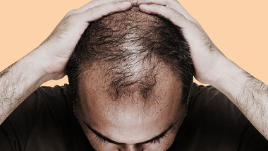 Why Does Our Hair Fall Out? How to Treat It?